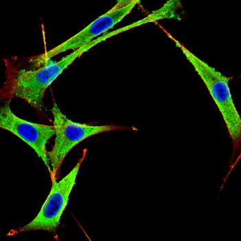 MUC16 Antibody