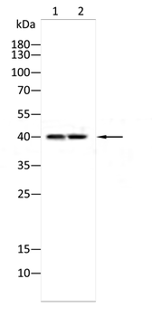 TGFBR1 Antibody