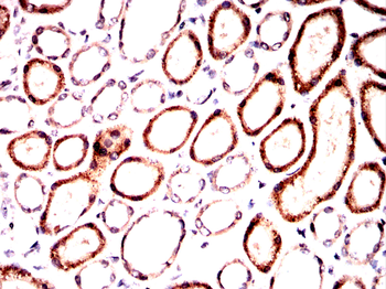 AXL Antibody