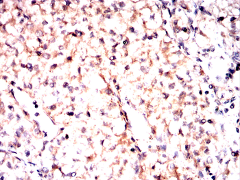 AXL Antibody
