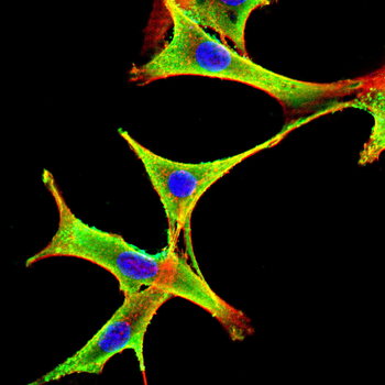 CHI3L1 Antibody