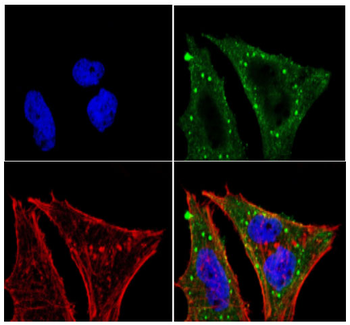 Cdkn2a Antibody