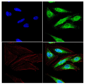 H2BC11 Antibody
