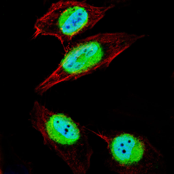 HOXB9 Antibody