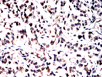 MAOA Antibody