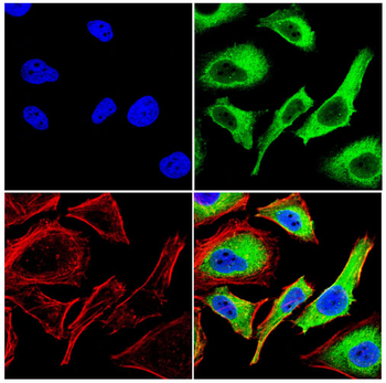 PTGDS Antibody