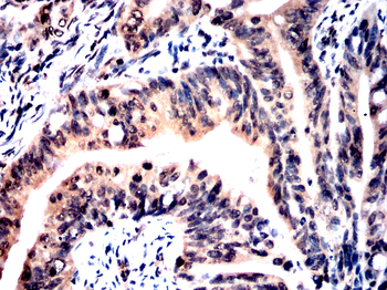 TYK2 Antibody