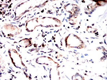 BAX Antibody