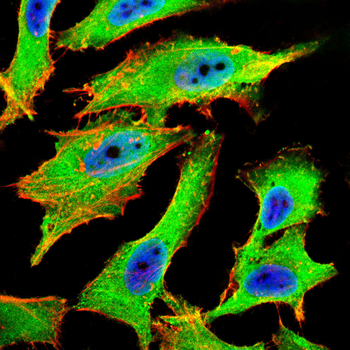 NME1 Antibody