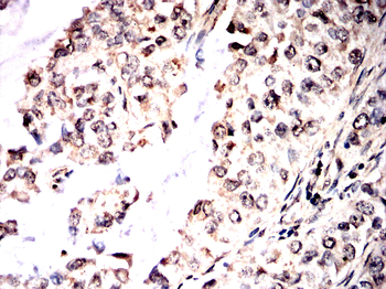 PAK2 Antibody