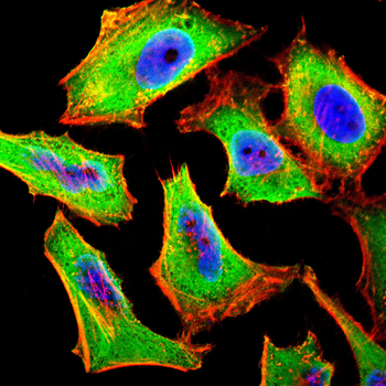 PAK2 Antibody