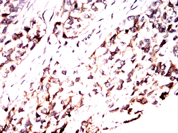 CDKN1A Antibody