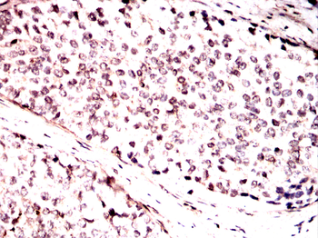 IRF3 Antibody