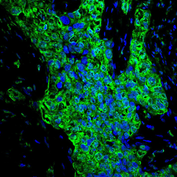 PRKAB1 Antibody