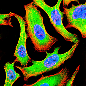 HSPB1 Antibody