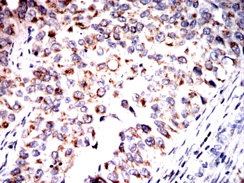 FH Antibody