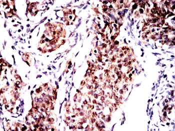 DNAJB1 Antibody