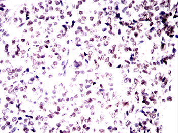 DNAJB1 Antibody