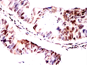 CBX5 Antibody
