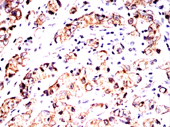 AQP4 Antibody