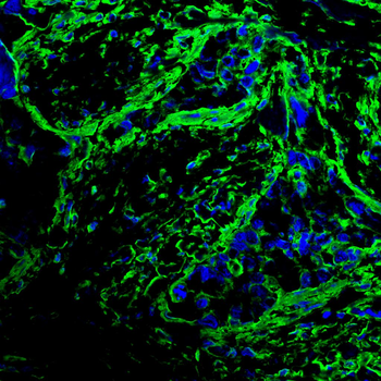 ACTA1 Antibody