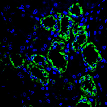 TUBA1B Antibody