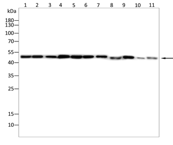 TUBA1B Antibody
