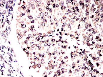SMAD3 Antibody