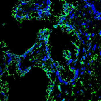 SMAD3 Antibody