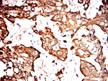 KRT17 Antibody
