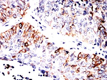 KRT17 Antibody