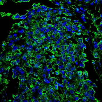 PRKAA1 Antibody