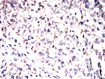 ACE2 Antibody