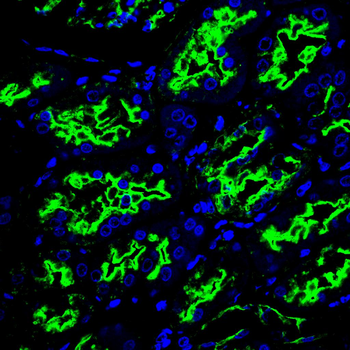 ACE2 Antibody