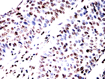 SPHK2 Antibody