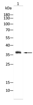 SPHK2 Antibody