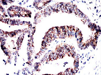 AMACR Antibody