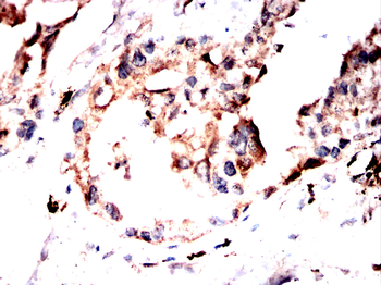 TFRC Antibody