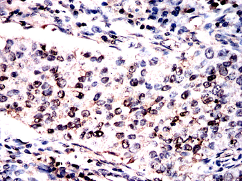 ADAR Antibody