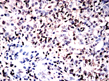 ADAR Antibody