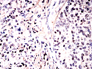 ADAR Antibody