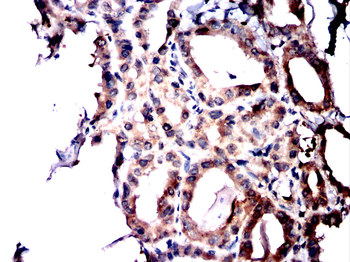 ADAR Antibody