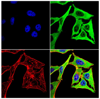 C5 Antibody