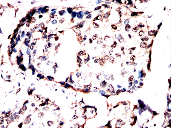 TBP Antibody