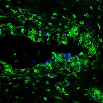 TBP Antibody