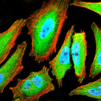 TBP Antibody
