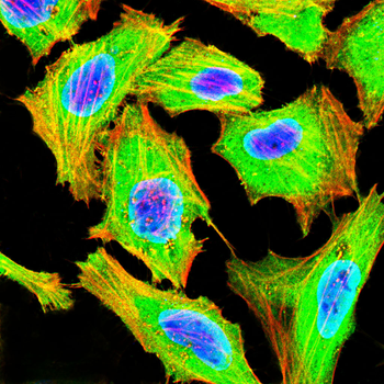 CALB1 Antibody