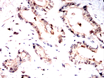 PAK1 Antibody