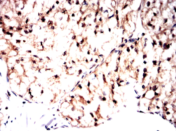PAK1 Antibody