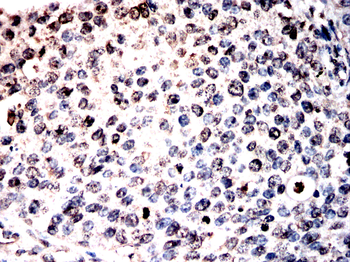 ANP32A Antibody